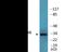 Cyclin Dependent Kinase 5 antibody, EKC2315, Boster Biological Technology, Western Blot image 