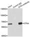 Serine/Threonine Kinase 4 antibody, LS-B14911, Lifespan Biosciences, Immunoprecipitation image 