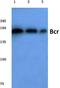 BCR Activator Of RhoGEF And GTPase antibody, AP06030PU-N, Origene, Western Blot image 