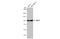 RING finger protein 43 antibody, GTX132671, GeneTex, Western Blot image 