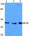 5-Hydroxytryptamine Receptor 5A antibody, GTX66853, GeneTex, Western Blot image 