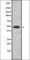 Melanoma-associated antigen 1 antibody, orb337026, Biorbyt, Western Blot image 