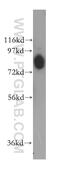 Collagen type IV alpha-3-binding protein antibody, 15191-1-AP, Proteintech Group, Western Blot image 