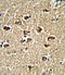 BicC Family RNA Binding Protein 1 antibody, LS-C156816, Lifespan Biosciences, Immunohistochemistry paraffin image 