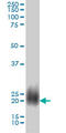 NBL1, DAN Family BMP Antagonist antibody, LS-C197748, Lifespan Biosciences, Western Blot image 