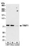 N(2),N(2)-dimethylguanosine tRNA methyltransferase antibody, A304-205A, Bethyl Labs, Western Blot image 