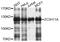 Zinc Finger CCCH-Type Containing 11A antibody, abx135962, Abbexa, Western Blot image 