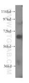 CD33 Molecule antibody, 17425-1-AP, Proteintech Group, Western Blot image 