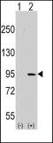Discoidin Domain Receptor Tyrosine Kinase 1 antibody, PA5-14177, Invitrogen Antibodies, Western Blot image 