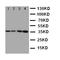Protein C, Inactivator Of Coagulation Factors Va And VIIIa antibody, LS-C312837, Lifespan Biosciences, Western Blot image 