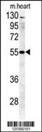 Beta-1,4-Galactosyltransferase 5 antibody, 61-901, ProSci, Western Blot image 