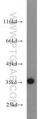 Plasminogen Activator, Tissue Type antibody, 10147-1-AP, Proteintech Group, Western Blot image 