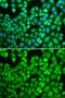 WAS antibody, GTX16382, GeneTex, Immunofluorescence image 