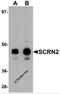 Secernin 2 antibody, 5851, ProSci Inc, Western Blot image 