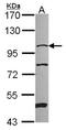 N-alpha-acetyltransferase 15, NatA auxiliary subunit antibody, NBP2-19477, Novus Biologicals, Western Blot image 