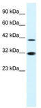 Interferon Regulatory Factor 2 antibody, TA330031, Origene, Western Blot image 