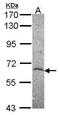 Histone Deacetylase 2 antibody, GTX113086, GeneTex, Western Blot image 