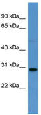 Sprouty Related EVH1 Domain Containing 2 antibody, TA342931, Origene, Western Blot image 