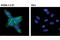 Lin-28 Homolog A antibody, 12573S, Cell Signaling Technology, Immunocytochemistry image 