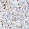 Plasma Cell Marker antibody, LS-C88220, Lifespan Biosciences, Immunohistochemistry paraffin image 