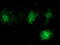 V-Set And Immunoglobulin Domain Containing 2 antibody, M15033, Boster Biological Technology, Immunofluorescence image 