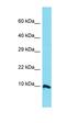 Chromosome 11 Open Reading Frame 94 antibody, orb326870, Biorbyt, Western Blot image 