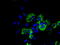 Aconitase antibody, TA500913S, Origene, Immunofluorescence image 