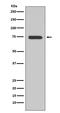 Bruton Tyrosine Kinase antibody, M00245, Boster Biological Technology, Western Blot image 