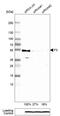 Coagulation Factor III, Tissue Factor antibody, AMAb91235, Atlas Antibodies, Western Blot image 