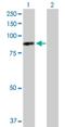 Dynein Axonemal Intermediate Chain 1 antibody, H00027019-D01P, Novus Biologicals, Western Blot image 