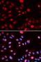N-Methylpurine DNA Glycosylase antibody, LS-C334049, Lifespan Biosciences, Immunofluorescence image 