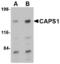 CAPS1 antibody, LS-B4590, Lifespan Biosciences, Western Blot image 