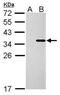 Collagen Type XI Alpha 2 Chain antibody, PA5-77919, Invitrogen Antibodies, Western Blot image 