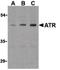 ANTXR Cell Adhesion Molecule 1 antibody, PA5-20016, Invitrogen Antibodies, Western Blot image 