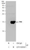 PBR antibody, GTX130550, GeneTex, Immunoprecipitation image 