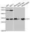 Tissue Factor Pathway Inhibitor antibody, TA332414, Origene, Western Blot image 