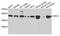 MHC Class I Polypeptide-Related Sequence A antibody, A1390, ABclonal Technology, Western Blot image 