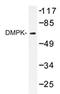 DM1 Protein Kinase antibody, AP20433PU-N, Origene, Western Blot image 
