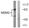 Hdm2 antibody, LS-C199238, Lifespan Biosciences, Western Blot image 