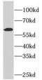 Phosphodiesterase 1A antibody, FNab06249, FineTest, Western Blot image 