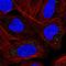 Midkine antibody, HPA057126, Atlas Antibodies, Immunofluorescence image 