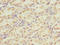 5'-Nucleotidase, Cytosolic IIIA antibody, orb40816, Biorbyt, Immunohistochemistry paraffin image 
