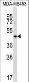 Hyaluronan And Proteoglycan Link Protein 3 antibody, LS-C166787, Lifespan Biosciences, Western Blot image 