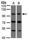 Vacuolar protein sorting-associated protein 11 homolog antibody, TA308196, Origene, Western Blot image 