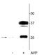Aquaporin 2 antibody, P00935-1, Boster Biological Technology, Western Blot image 