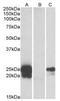 WAP Four-Disulfide Core Domain 2 antibody, AP22455PU-N, Origene, Western Blot image 
