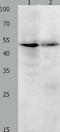 Kruppel Like Factor 5 antibody, TA323126, Origene, Western Blot image 