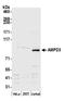 Adenosine Monophosphate Deaminase 3 antibody, A305-544A, Bethyl Labs, Western Blot image 