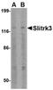 SLIT And NTRK Like Family Member 3 antibody, orb74938, Biorbyt, Western Blot image 