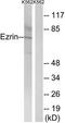Ezrin antibody, TA326071, Origene, Western Blot image 